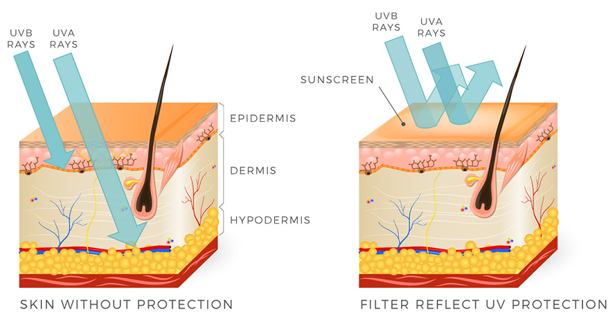 promieniowanie słoneczne na skórę bez ochrony vs z filtrem UV